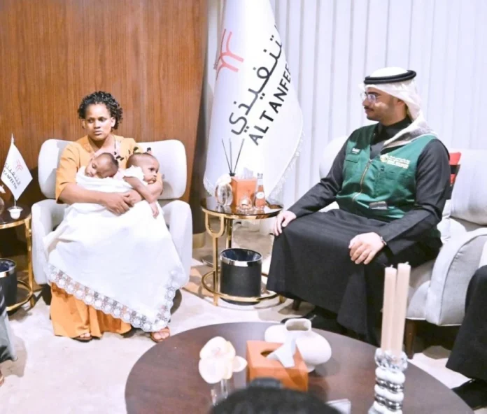 المملكة تستقبل 3 توائم ملتصقة من تنزانيا والفلبين للفصل الجراحي