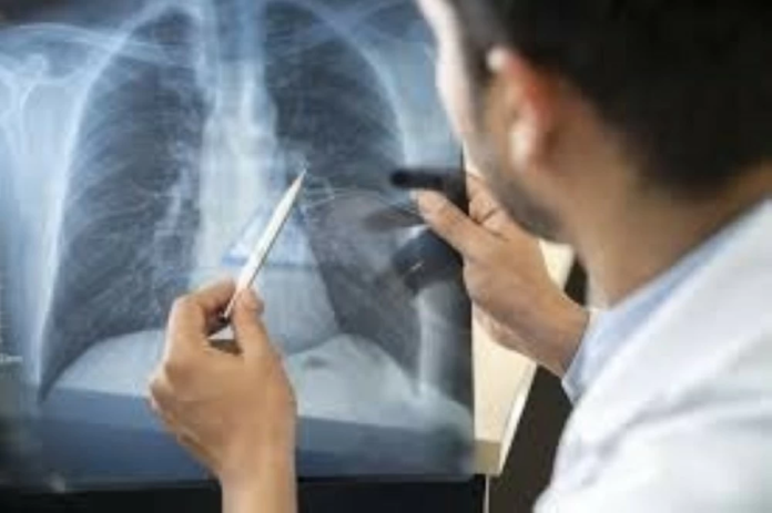 دراسة: العفن المنزلي يضر رئات الأطفال على المدى الطويل