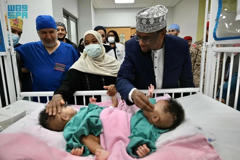 عملية فصل التوأم الصومالي رحمة ورملا