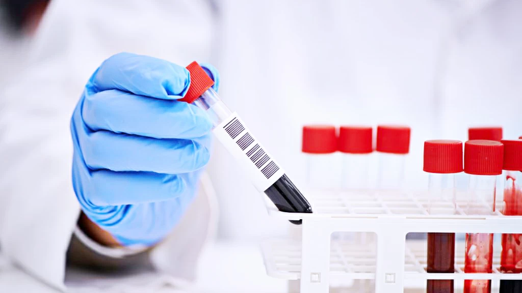 فحص ما قبل الزواج في السعودية