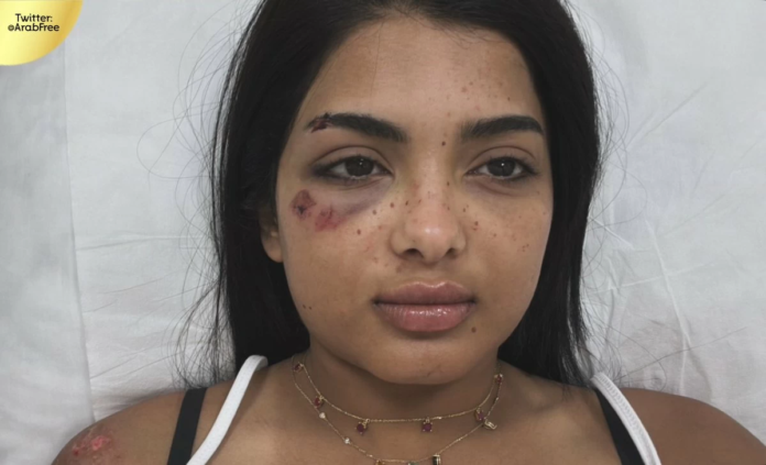 تطورات حادث جود السفياني المروري وحالتها الصحية