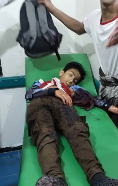 جريمة حرب في تعز: قناص حوثي يقتل طفلاً عائداً من مدرسته