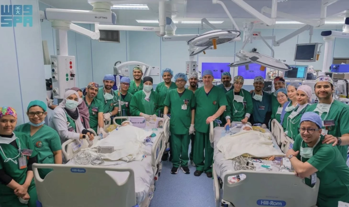 عملية فصل التوأم الملتصق الفلبيني: إنجاز طبي سعودي