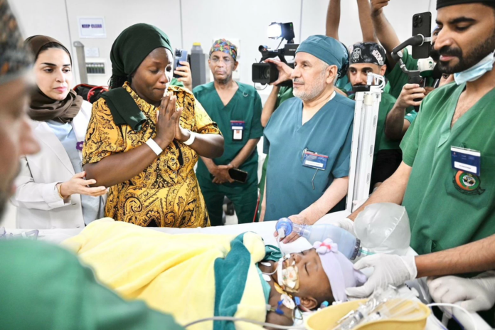 نجاح عملية فصل التوأم الملتصق التنزاني 