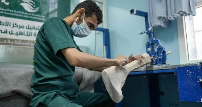 مركز الأطراف الصناعية في مأرب يغيث مئات المرضى باليمن